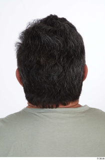  Photos of Umberto Espinar hair head 0005.jpg